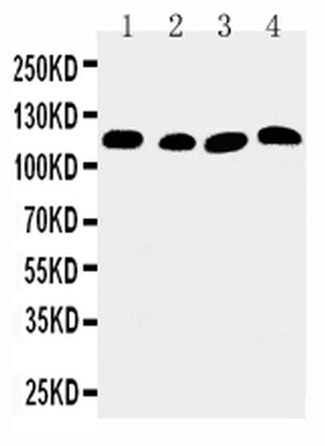 SERCA2 ATPase Antibody in Western Blot (WB)