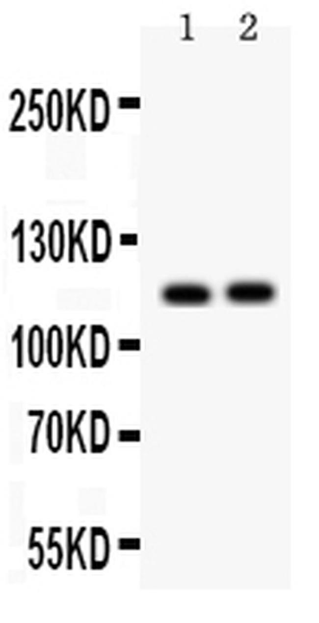 SERCA2 ATPase Antibody in Western Blot (WB)