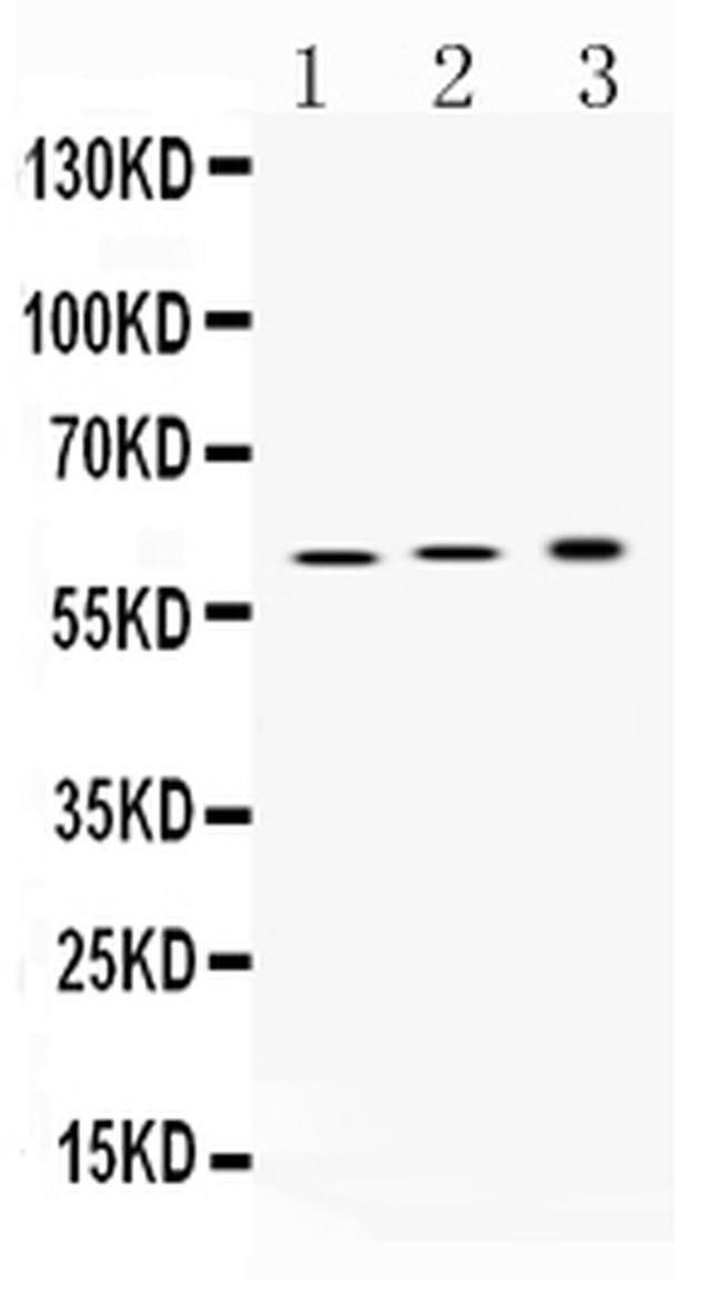 ATP4B Antibody in Western Blot (WB)