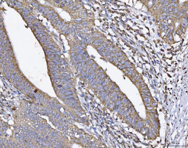 ATP5H Antibody in Immunohistochemistry (Paraffin) (IHC (P))