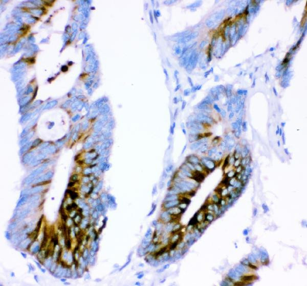 Ataxin 1 Antibody in Immunohistochemistry (Paraffin) (IHC (P))