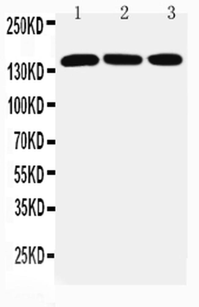 Ataxin 2 Antibody in Western Blot (WB)