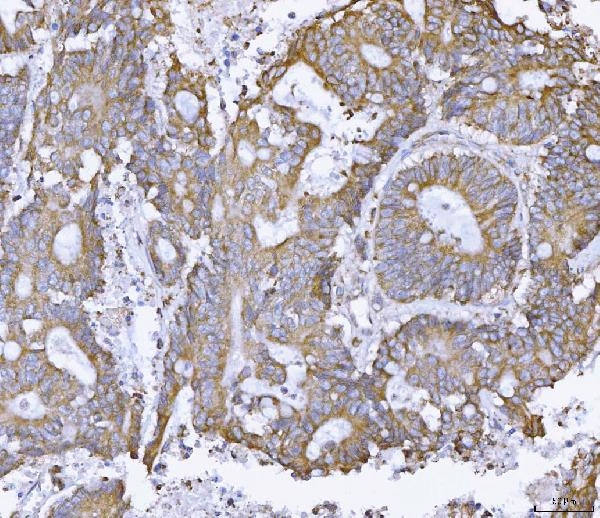 Ataxin 2 Antibody in Immunohistochemistry (Paraffin) (IHC (P))