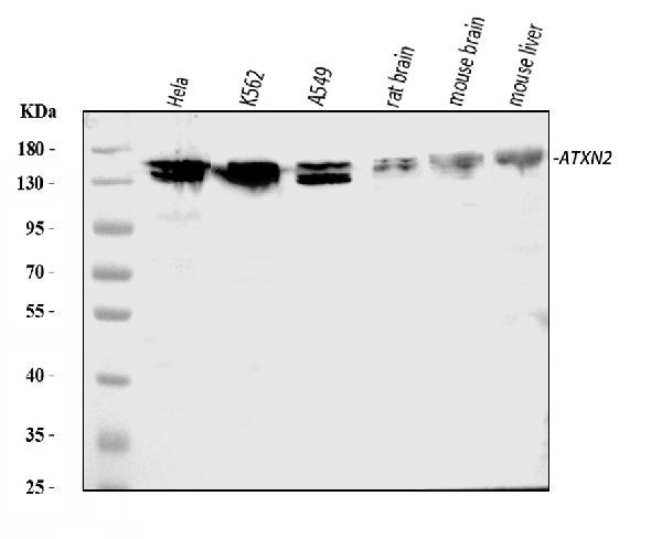 Ataxin 2 Antibody in Western Blot (WB)