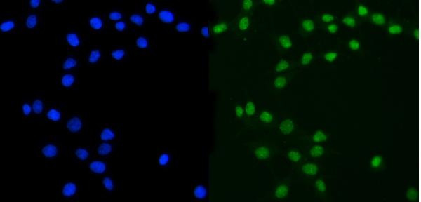 Ataxin 3 Antibody in Immunocytochemistry (ICC/IF)