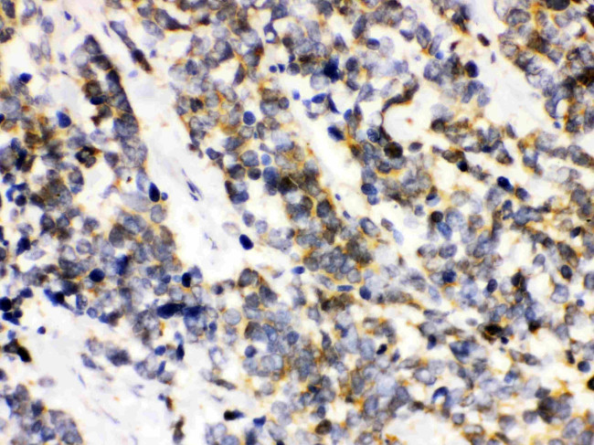 Ataxin 3 Antibody in Immunohistochemistry (Paraffin) (IHC (P))