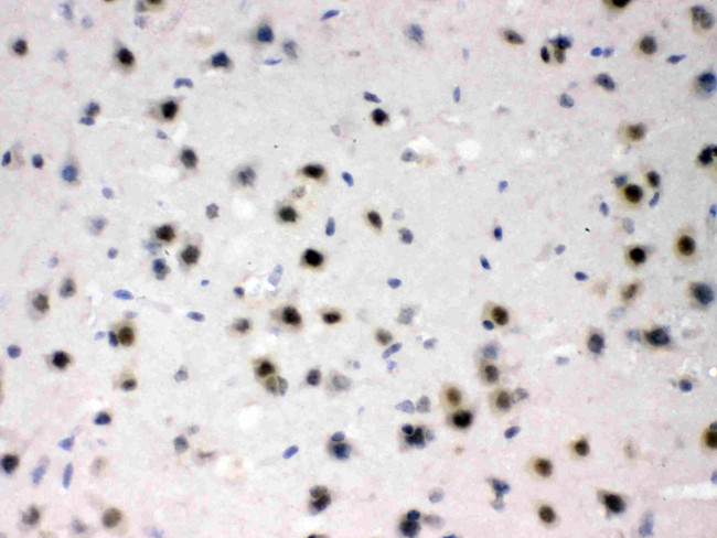 ADC Antibody in Immunohistochemistry (Paraffin) (IHC (P))