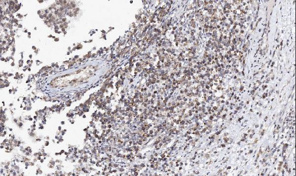 ADC Antibody in Immunohistochemistry (Paraffin) (IHC (P))