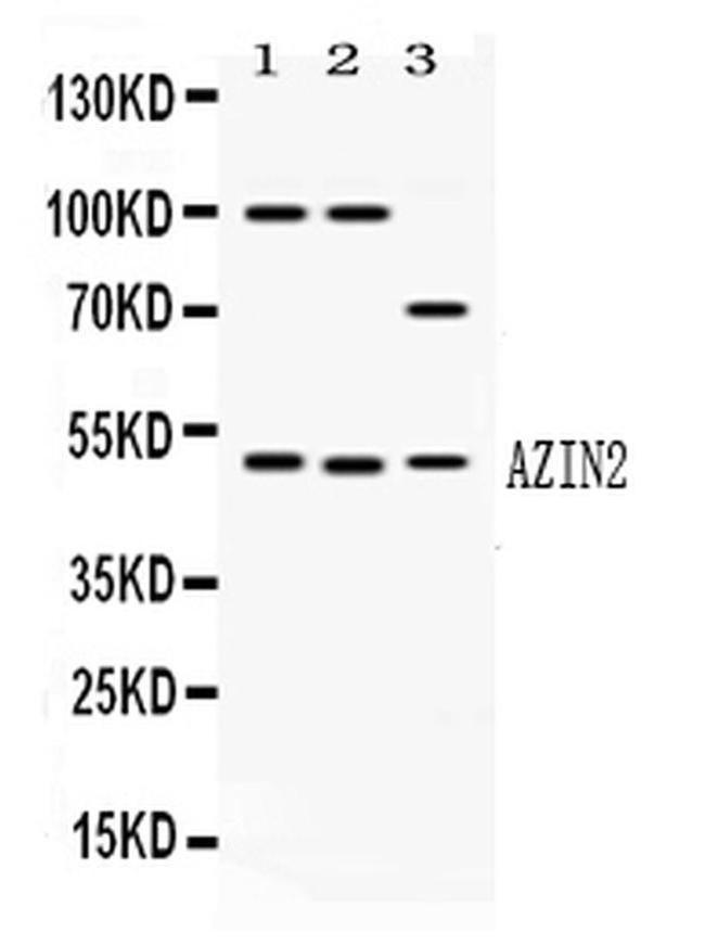 ADC Antibody in Western Blot (WB)