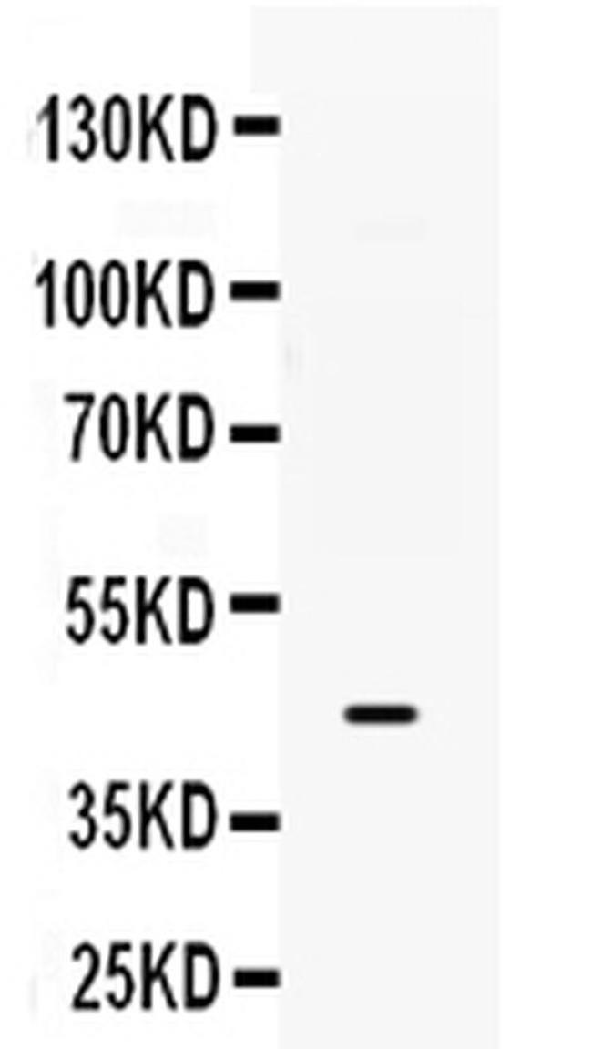 B3GNT8 Antibody in Western Blot (WB)