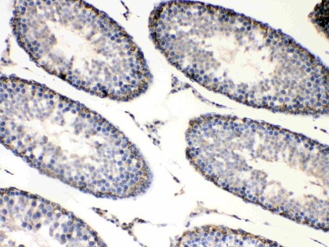 BAG1 Antibody in Immunohistochemistry (Paraffin) (IHC (P))