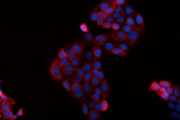 BAG2 Antibody in Immunocytochemistry (ICC/IF)