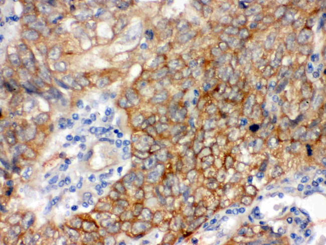 BAG3 Antibody in Immunohistochemistry (Paraffin) (IHC (P))