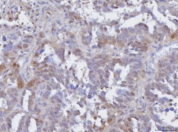 BCAT1 Antibody in Immunohistochemistry (Paraffin) (IHC (P))