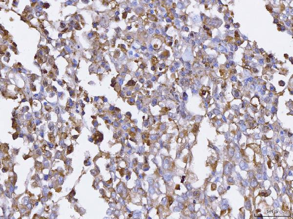 BCAT1 Antibody in Immunohistochemistry (Paraffin) (IHC (P))