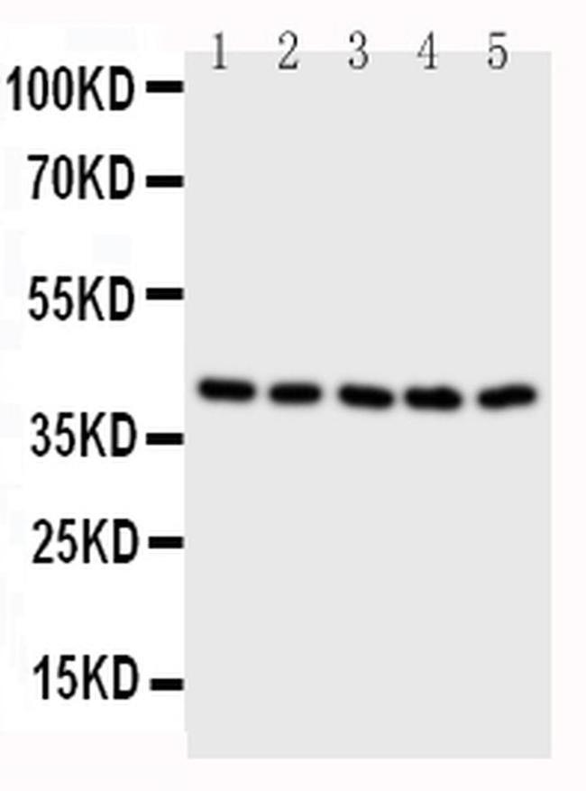 BCAT2 Antibody in Western Blot (WB)