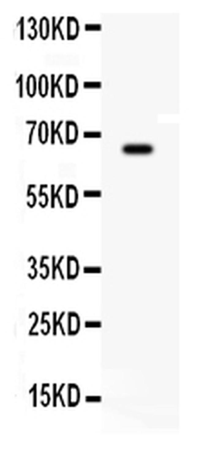 Butyrylcholinesterase Antibody in Western Blot (WB)