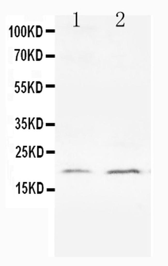Bcl-XS Antibody in Western Blot (WB)