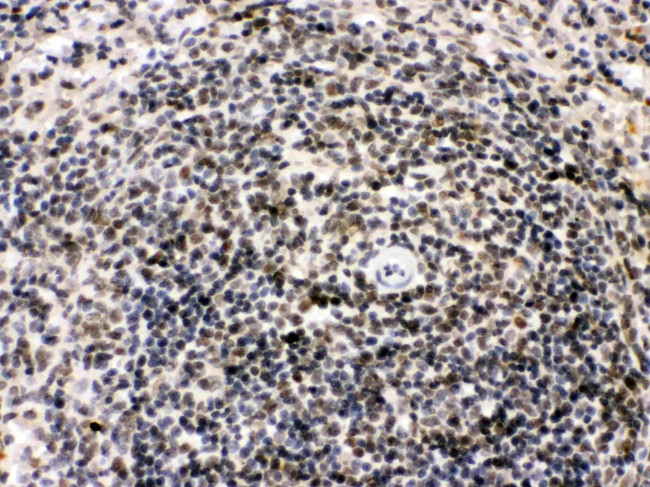 BIK Antibody in Immunohistochemistry (Paraffin) (IHC (P))