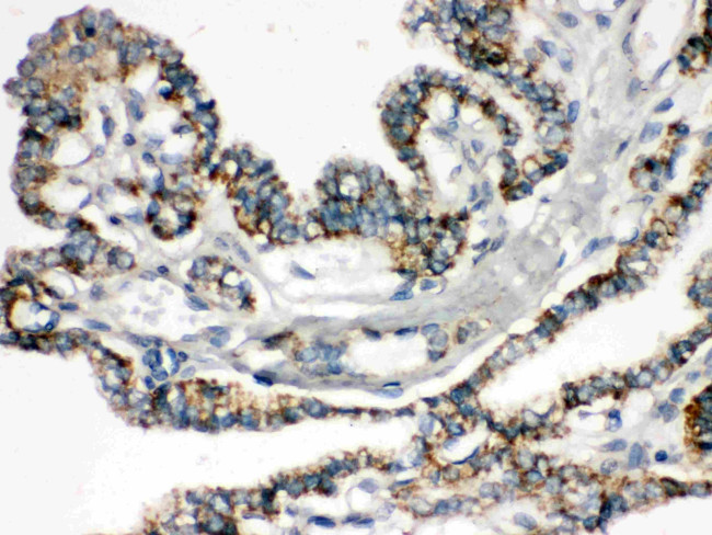 BIK Antibody in Immunohistochemistry (Paraffin) (IHC (P))