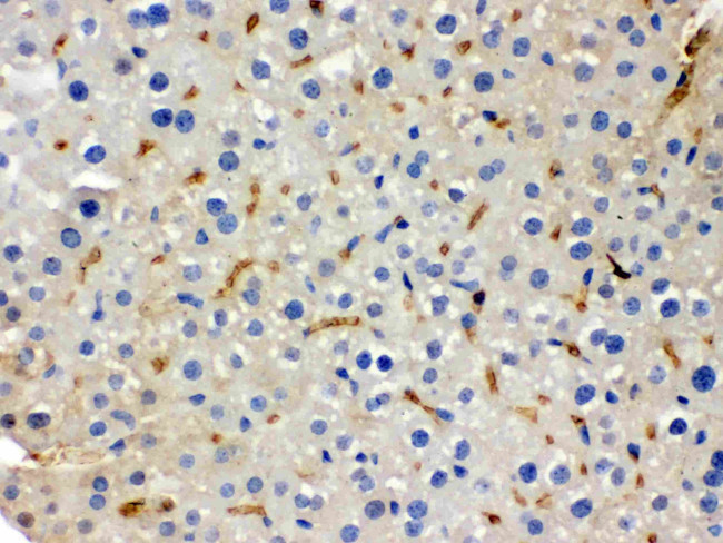 BMP5 Antibody in Immunohistochemistry (Paraffin) (IHC (P))