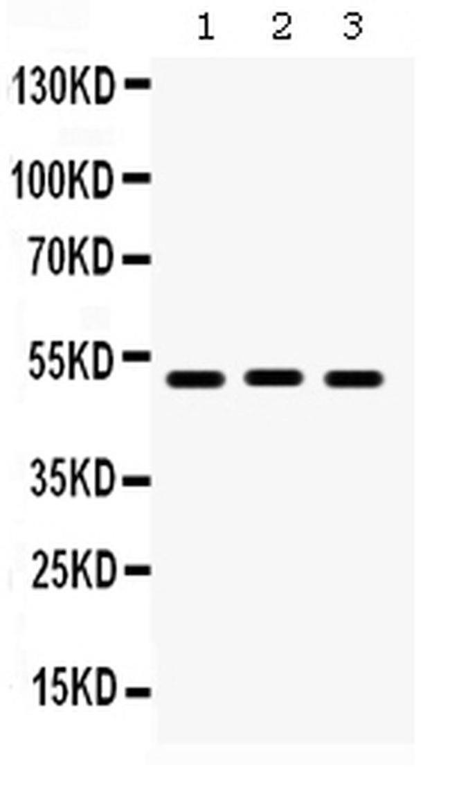 BMP5 Antibody in Western Blot (WB)