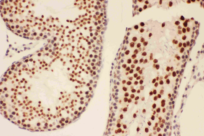 BRCA1 Antibody in Immunohistochemistry (Paraffin) (IHC (P))