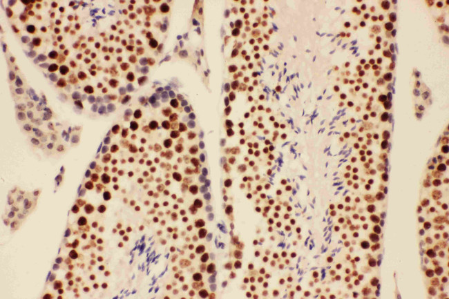 BRCA1 Antibody in Immunohistochemistry (Paraffin) (IHC (P))