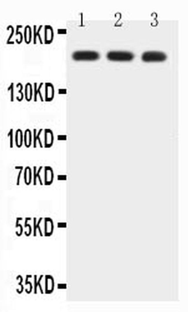 BRCA1 Antibody in Western Blot (WB)