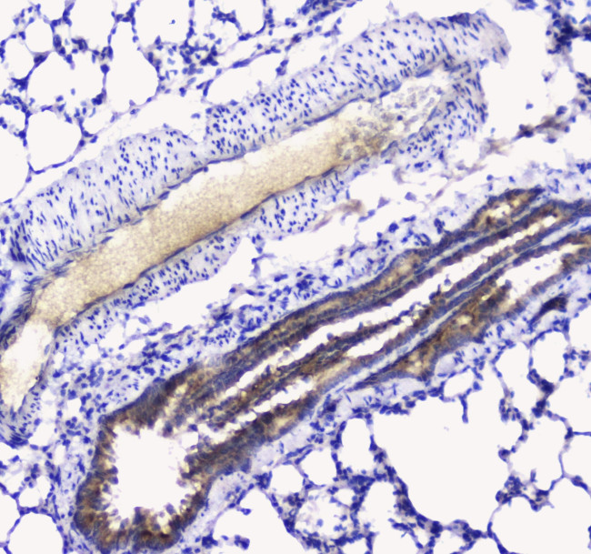 betacellulin Antibody in Immunohistochemistry (Paraffin) (IHC (P))