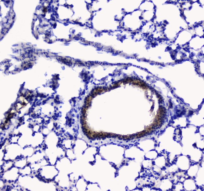 betacellulin Antibody in Immunohistochemistry (Paraffin) (IHC (P))