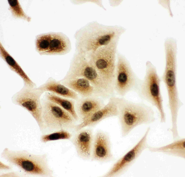 Bub3 Antibody in Immunocytochemistry (ICC/IF)