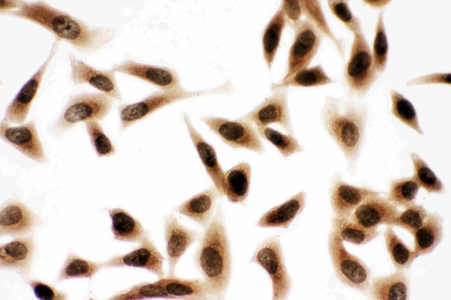 Bub3 Antibody in Immunocytochemistry (ICC/IF)