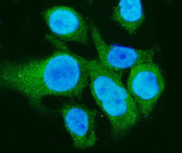 Carbonic Anhydrase I Antibody in Immunocytochemistry (ICC/IF)