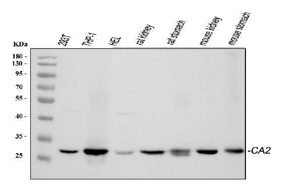 Carbonic Anhydrase II Antibody in Western Blot (WB)