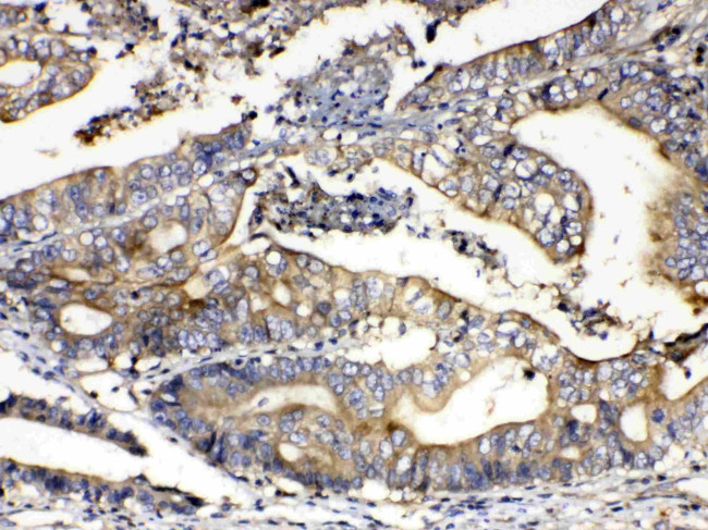 Calpain 2 Antibody in Immunohistochemistry (Paraffin) (IHC (P))