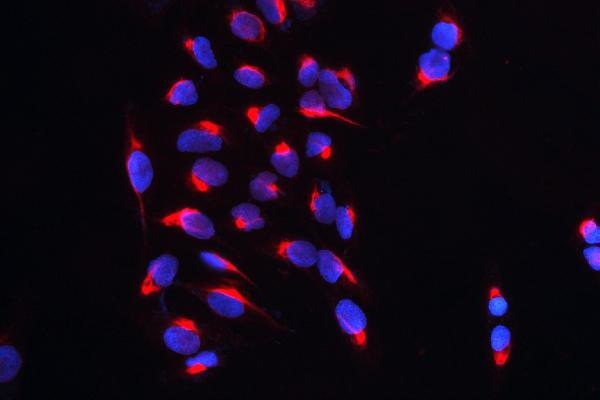 CARS Antibody in Immunocytochemistry (ICC/IF)