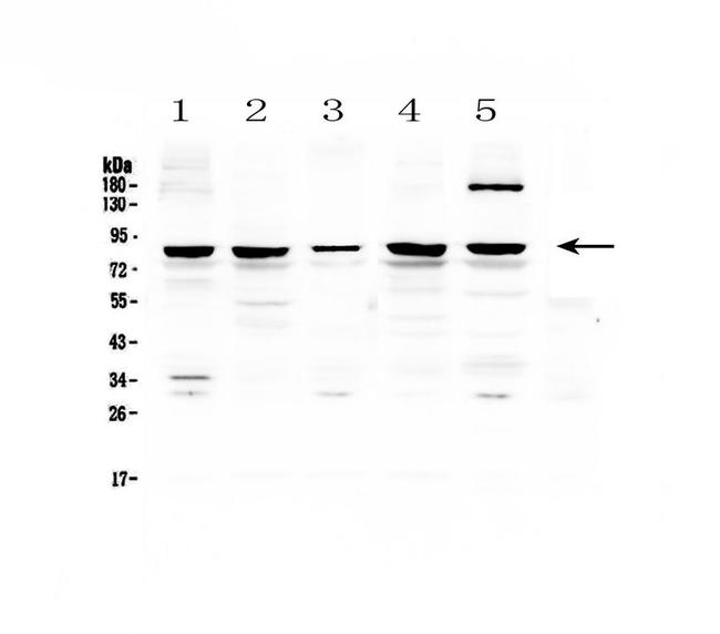 CARS Antibody in Western Blot (WB)