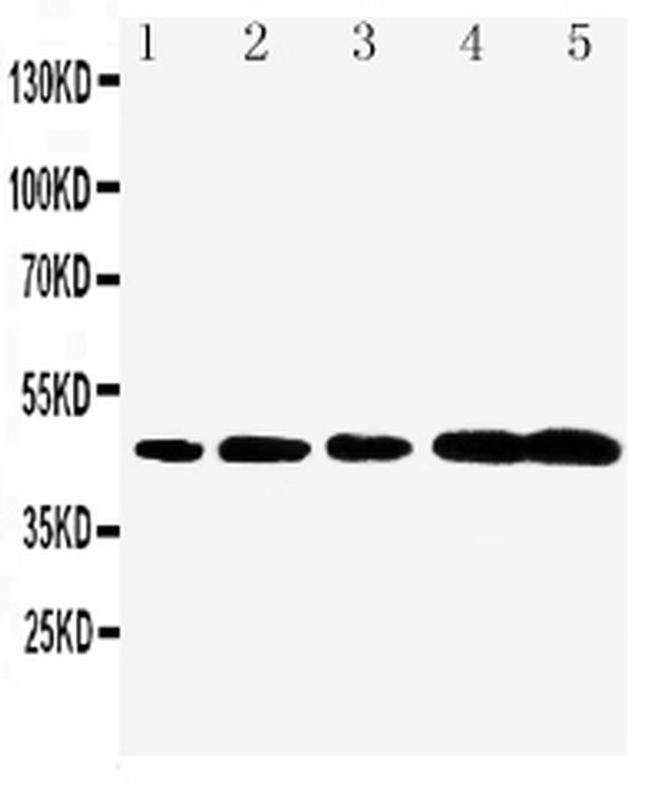 Caspase 1 p20 Antibody in Western Blot (WB)