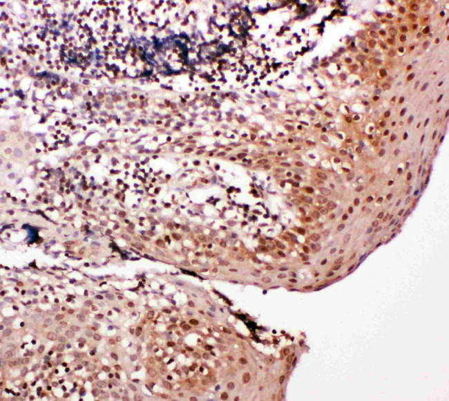 Caspase 14 Antibody in Immunohistochemistry (Paraffin) (IHC (P))