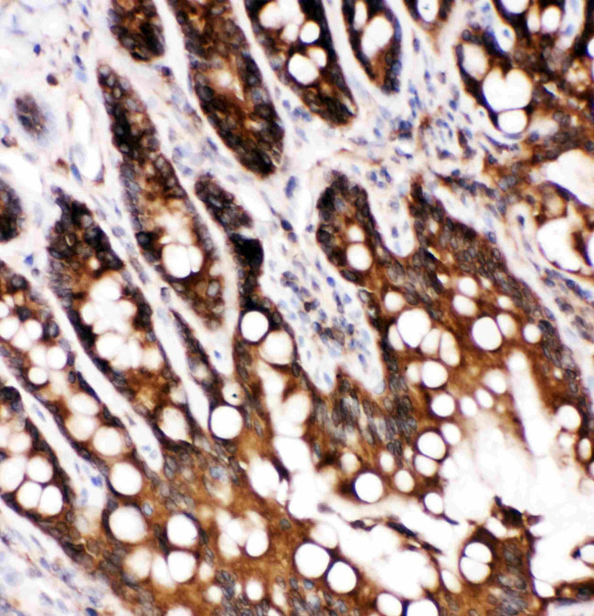 Caspase 6 p18 Antibody in Immunohistochemistry (Paraffin) (IHC (P))