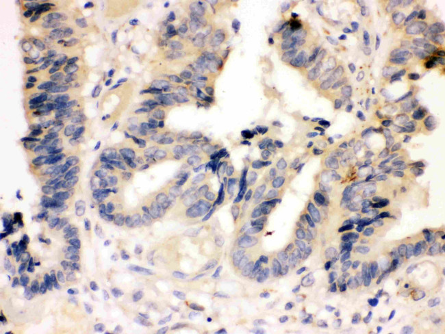 Caspase 7 p11 Antibody in Immunohistochemistry (Paraffin) (IHC (P))