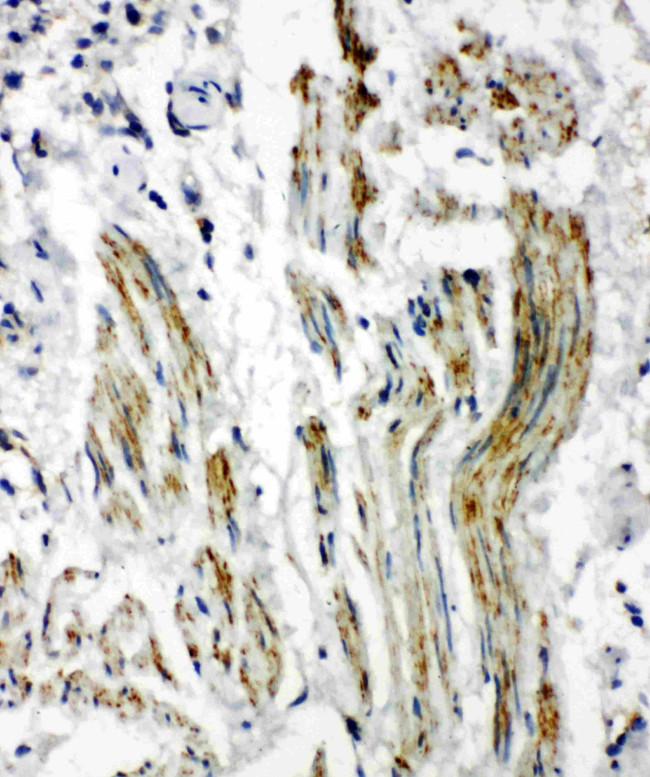 Caveolin 2 Antibody in Immunohistochemistry (Paraffin) (IHC (P))