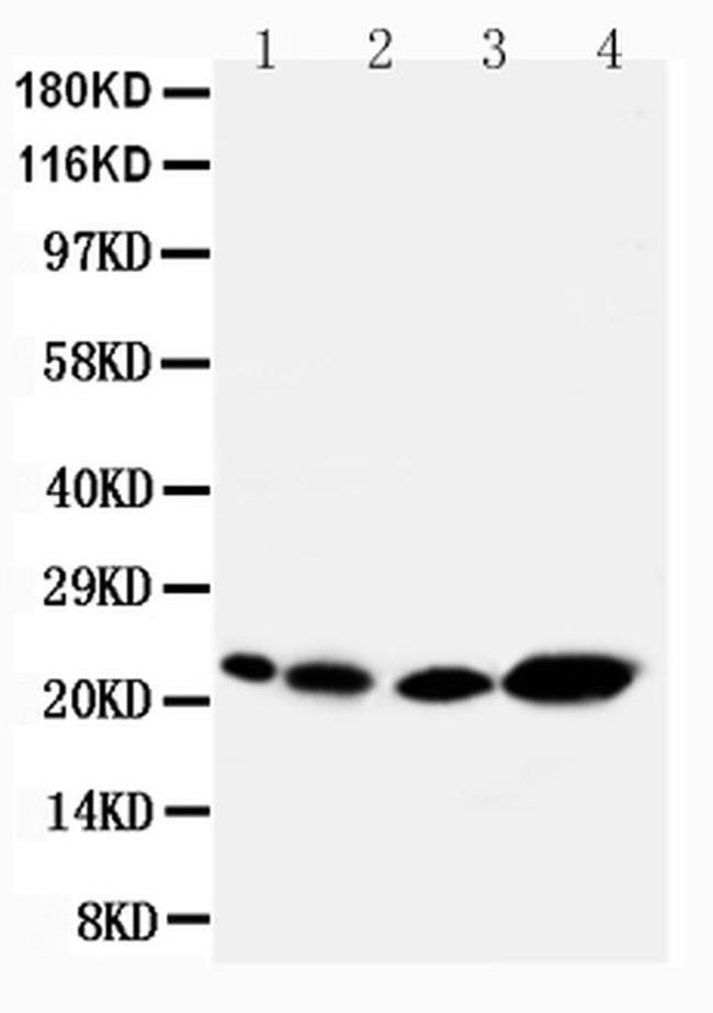 Caveolin 2 Antibody in Western Blot (WB)