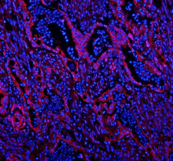 Caveolin 2 Antibody in Immunohistochemistry (IHC)