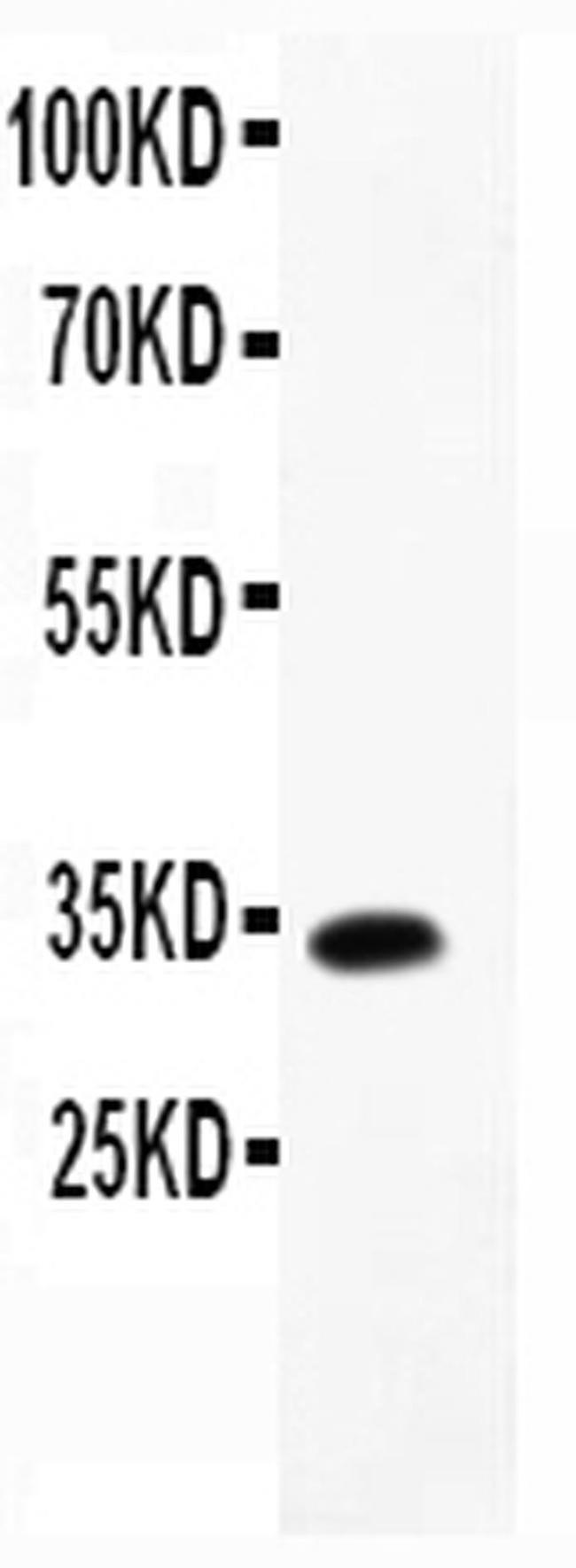 TARC Antibody in Western Blot (WB)