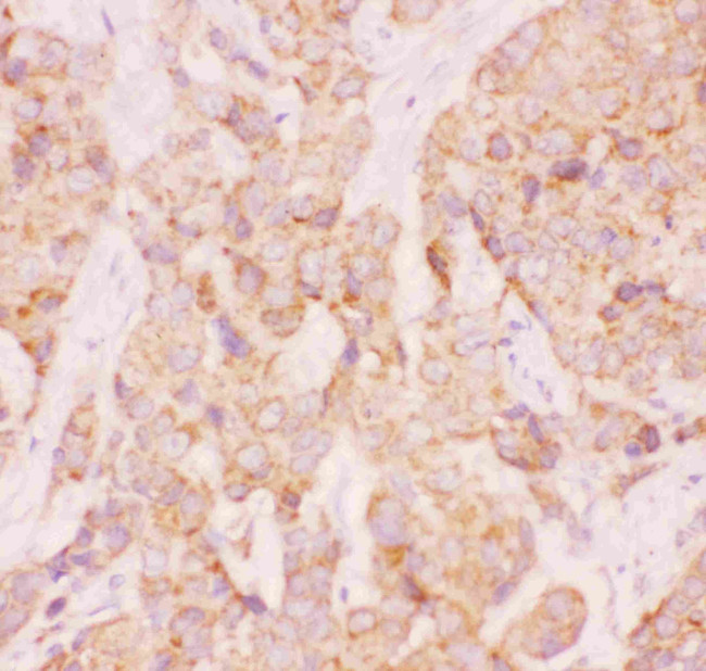 AAMP Antibody in Immunohistochemistry (Paraffin) (IHC (P))