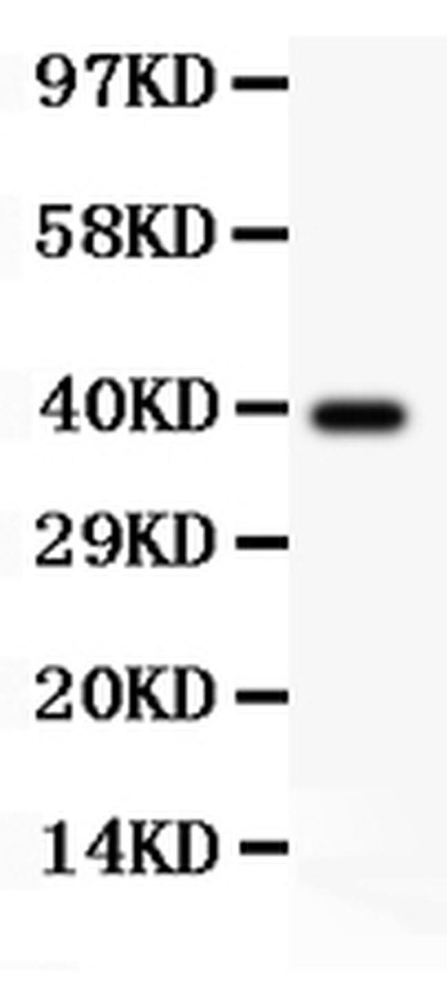 AAMP Antibody in Western Blot (WB)