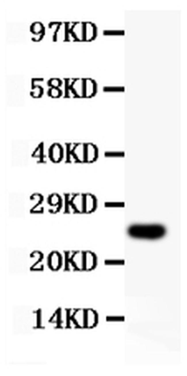 Cyclin D3 Antibody in Western Blot (WB)