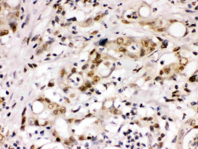 Cyclin T1 Antibody in Immunohistochemistry (Paraffin) (IHC (P))